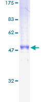 12.5% SDS-PAGE Stained with Coomassie Blue.